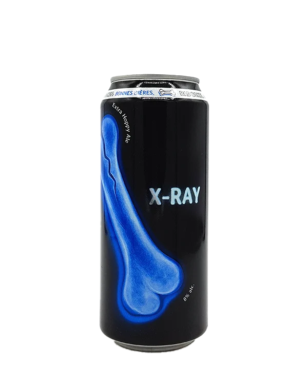 X-Ray